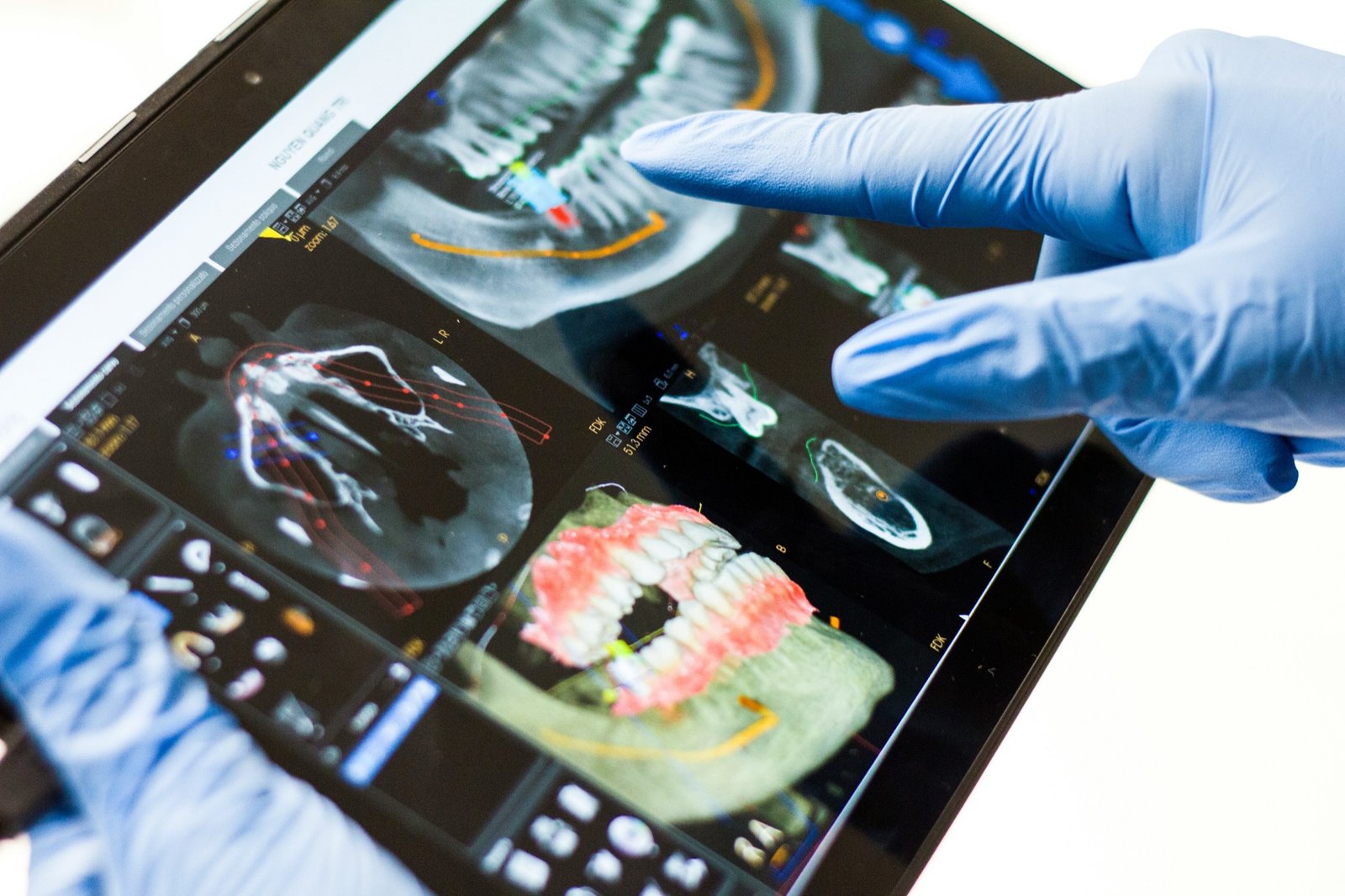 Dentist reviewing digital dental scans on a tablet